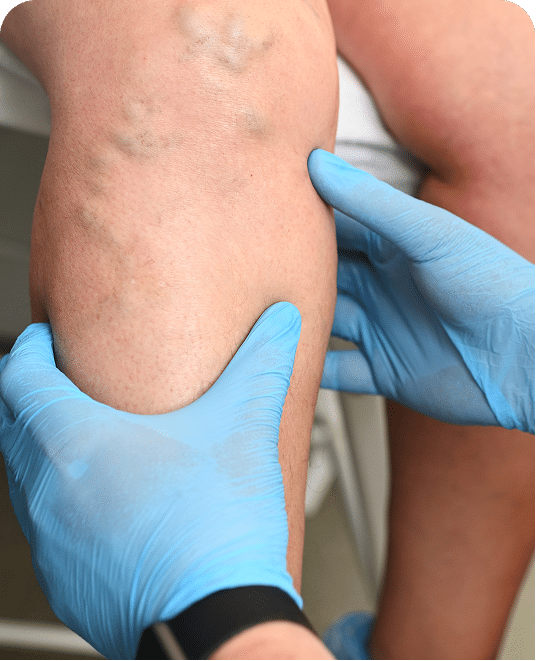 Vein and Vascular Care